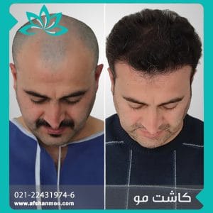 kashtemoo7